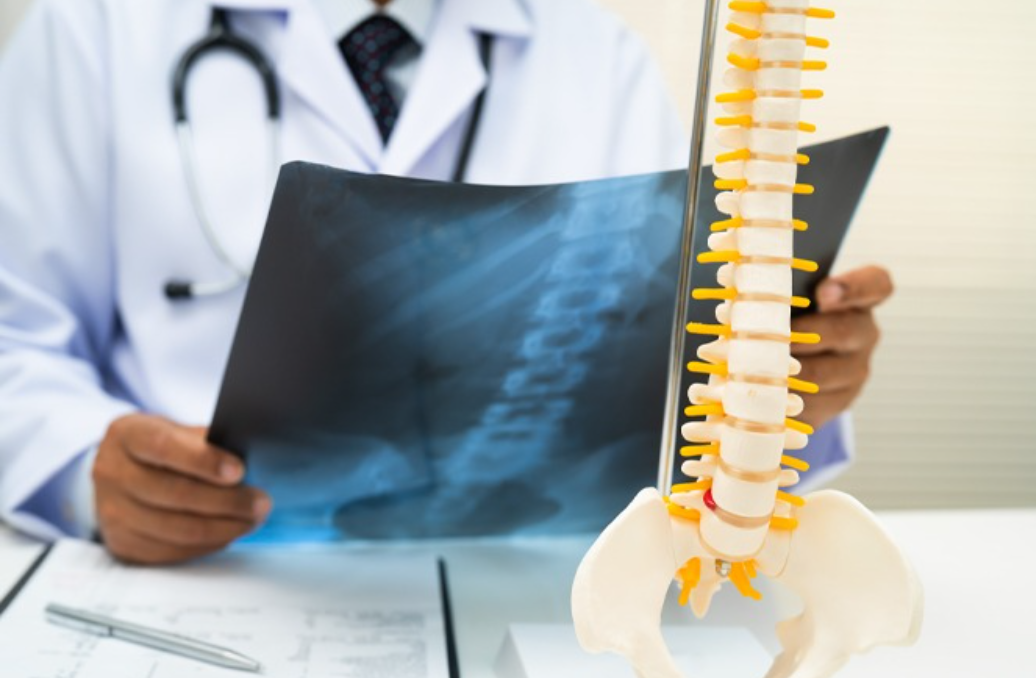 TJSC mantém condenações por esquema de ‘fura fila’ no SUS no Oeste catarinense